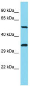 Pancreatic Lipase Related Protein 3 antibody, TA334144, Origene, Western Blot image 