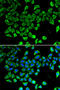 Lipocalin 2 antibody, LS-C746890, Lifespan Biosciences, Immunofluorescence image 