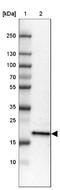 Zinc Finger Protein 22 antibody, NBP1-81739, Novus Biologicals, Western Blot image 