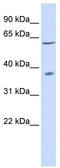 Purinergic Receptor P2X 2 antibody, TA338744, Origene, Western Blot image 