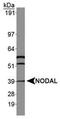 Nodal Growth Differentiation Factor antibody, PA5-23084, Invitrogen Antibodies, Western Blot image 
