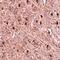 Translocase Of Outer Mitochondrial Membrane 70 antibody, orb75117, Biorbyt, Immunohistochemistry paraffin image 