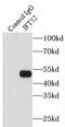 Intraflagellar Transport 52 antibody, FNab04159, FineTest, Immunoprecipitation image 