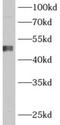 Alcohol Dehydrogenase Iron Containing 1 antibody, FNab00168, FineTest, Western Blot image 