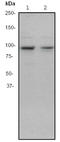 Eukaryotic Elongation Factor 2 Kinase antibody, TA300638, Origene, Western Blot image 