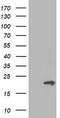 Phosphomevalonate Kinase antibody, CF503449, Origene, Western Blot image 