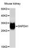 Glucosamine-6-Phosphate Deaminase 1 antibody, STJ23826, St John