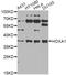Homeobox protein Hox-A1 antibody, STJ29004, St John