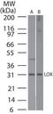 Lysyl Oxidase antibody, TA337077, Origene, Western Blot image 