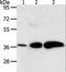 Aldo-keto reductase family 1 member C1 antibody, LS-C402612, Lifespan Biosciences, Western Blot image 