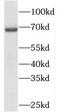 Protein Inhibitor Of Activated STAT 2 antibody, FNab06429, FineTest, Western Blot image 