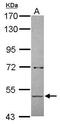 Amylase Alpha 2B (Pancreatic) antibody, GTX112396, GeneTex, Western Blot image 