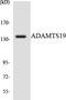 ADAM Metallopeptidase With Thrombospondin Type 1 Motif 19 antibody, LS-C200086, Lifespan Biosciences, Western Blot image 