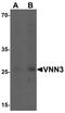 Vanin 3 antibody, TA326633, Origene, Western Blot image 