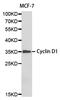 Cyclin D1 antibody, abx123414, Abbexa, Western Blot image 