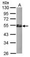 Kruppel Like Factor 17 antibody, PA5-31774, Invitrogen Antibodies, Western Blot image 