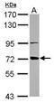 ATP Binding Cassette Subfamily B Member 10 antibody, PA5-30468, Invitrogen Antibodies, Western Blot image 