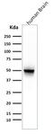 GFAP antibody, GTX34758, GeneTex, Western Blot image 