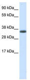 ERCC Excision Repair 8, CSA Ubiquitin Ligase Complex Subunit antibody, TA329915, Origene, Western Blot image 