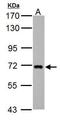 Zinc Finger DHHC-Type Containing 17 antibody, PA5-29942, Invitrogen Antibodies, Western Blot image 