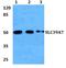 Solute Carrier Family 39 Member 7 antibody, A07719-3, Boster Biological Technology, Western Blot image 
