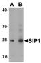 Survival of motor neuron protein-interacting protein 1 antibody, orb94540, Biorbyt, Western Blot image 
