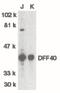 DFF40 antibody, PA5-19928, Invitrogen Antibodies, Western Blot image 