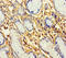 Prokineticin Receptor 1 antibody, A63230-100, Epigentek, Immunohistochemistry paraffin image 