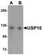 Ubiquitin Specific Peptidase 10 antibody, PA5-20987, Invitrogen Antibodies, Western Blot image 