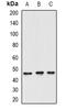 Cytotoxic T-Lymphocyte Associated Protein 4 antibody, orb378016, Biorbyt, Western Blot image 