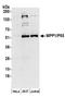 Membrane Palmitoylated Protein 1 antibody, A304-431A, Bethyl Labs, Western Blot image 