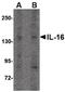 Pro-interleukin-16 antibody, PA5-20670, Invitrogen Antibodies, Western Blot image 