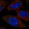 RIB43A Domain With Coiled-Coils 1 antibody, HPA001150, Atlas Antibodies, Immunocytochemistry image 
