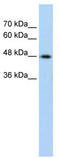 Keratin 17 antibody, TA346189, Origene, Western Blot image 