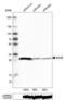 DHSB antibody, NBP2-52921, Novus Biologicals, Western Blot image 