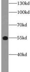 CMKLR1 antibody, FNab10506, FineTest, Western Blot image 
