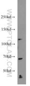SEC24 Homolog C, COPII Coat Complex Component antibody, 16073-1-AP, Proteintech Group, Western Blot image 