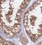 Fatty Acid Binding Protein 12 antibody, NBP1-93537, Novus Biologicals, Immunohistochemistry frozen image 
