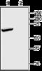 Potassium channel subfamily K member 2 antibody, GTX16653, GeneTex, Western Blot image 