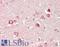 Chloride Voltage-Gated Channel 7 antibody, LS-B14661, Lifespan Biosciences, Immunohistochemistry paraffin image 