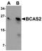 BCAS2 Pre-MRNA Processing Factor antibody, NBP1-77124, Novus Biologicals, Western Blot image 