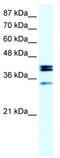 Nuclear Receptor Subfamily 5 Group A Member 1 antibody, TA330584, Origene, Western Blot image 