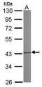 Acetyl-CoA Acetyltransferase 1 antibody, GTX102637, GeneTex, Western Blot image 