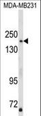 TBC1 Domain Family Member 4 antibody, LS-C161734, Lifespan Biosciences, Western Blot image 