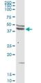 C-C Motif Chemokine Receptor 5 (Gene/Pseudogene) antibody, H00001234-D01P, Novus Biologicals, Western Blot image 