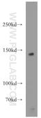Sterol regulatory element-binding protein cleavage-activating protein antibody, 12266-1-AP, Proteintech Group, Western Blot image 