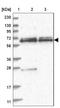 Sperm Associated Antigen 16 antibody, NBP1-84124, Novus Biologicals, Western Blot image 