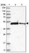 Zinc Finger Protein 787 antibody, PA5-57174, Invitrogen Antibodies, Western Blot image 