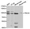Protein Kinase C Epsilon antibody, TA327275, Origene, Western Blot image 
