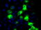 Cytochrome P450 Family 2 Subfamily E Member 1 antibody, TA500734, Origene, Immunofluorescence image 